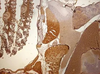 Creatine kinase (brain) antibo