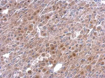 TNFAIP2 antibody [C1C3]