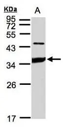 ICAM2 antibody [N1C2]