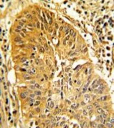 Caldesmon antibody, Internal
