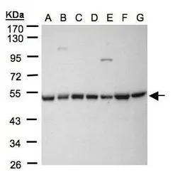 HDAC3 antibody [C3], C-term