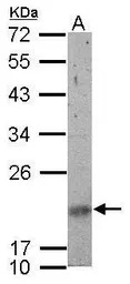 SNRPN antibody