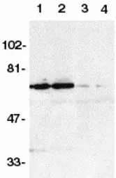 DR6 antibody