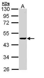 PPM1A antibody