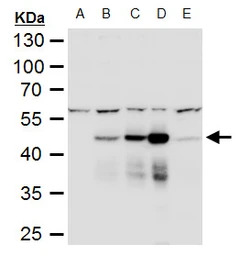 Dengue virus NS1 protein antib