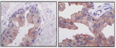 AMACR antibody [2A10F3]