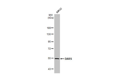 DARS antibody