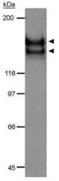 VEGF Receptor 2 antibody