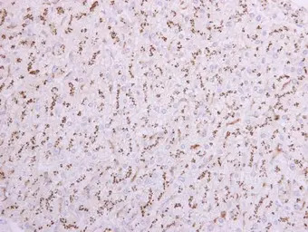 ST6GAL1 antibody [N2C3]