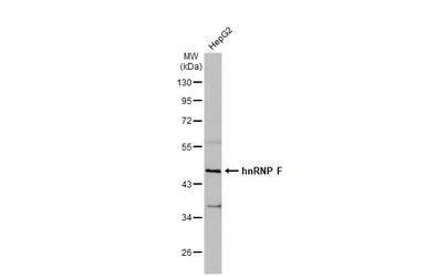 hnRNP F antibody [N1N3]