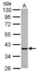 CDK6 antibody [N3C3]