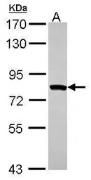 MTMR2 antibody [C1C3]