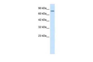 KCNN3 antibody, C-term