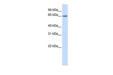 YTHDF3 antibody, N-term