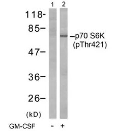 p70 S6K (phospho Thr421) antib