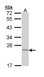 TNFAIP8 antibody [N1C3-2]