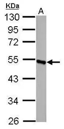 DBT antibody
