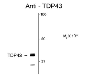 TDP43 antibody