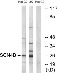 SCN4B antibody