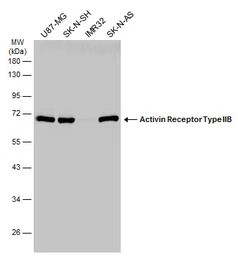Activin Receptor Type IIB anti