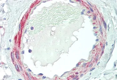 VPS35 antibody, C-term