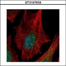 SPHK1 antibody