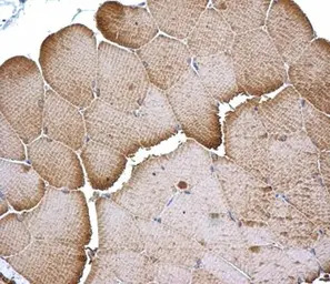 Tropomyosin 1 antibody