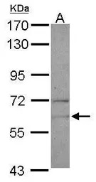 NARS antibody