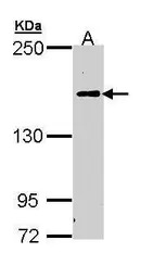 C5 / C5b antibody [C2C3-2], C-