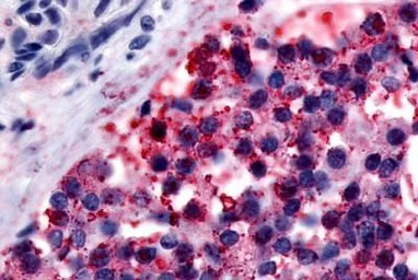 Calcitonin Receptor antibody