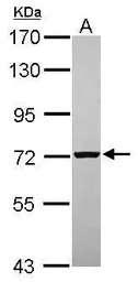 PGM2 antibody [N1C2]