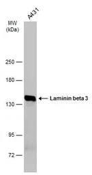 Laminin beta 3 antibody [C1C2]