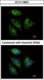 ABCF3 antibody [N1N3]