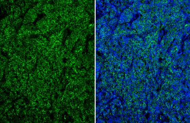 CD19 antibody [C1C3]
