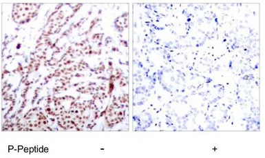 ATF2 (phospho Thr73) antibody