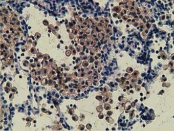 ZIM2 antibody [5E12]