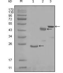 Lysyl-tRNA synthetase antibody