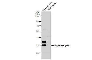 Aspartoacylase antibody [N1C3-