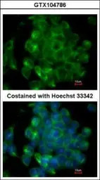 SIPA1 antibody [C3], C-term