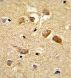 C6orf170 antibody, N-term