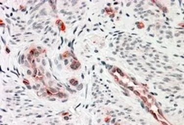 DKK3 antibody, C-term