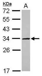 UTP11L antibody [N1C3]