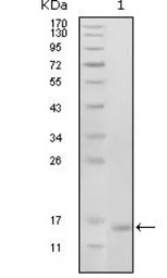 EphB6 antibody [2A6B9]