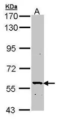 PLA2G3 antibody [C1C3]