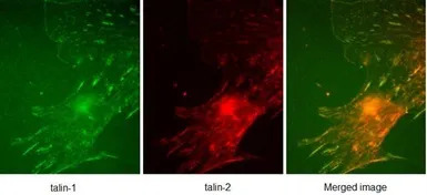 Talin-1 antibody [97H6]