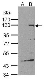 SIPA1 antibody [C3], C-term