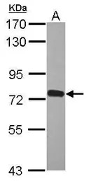 ZNF417 antibody [N1C1]