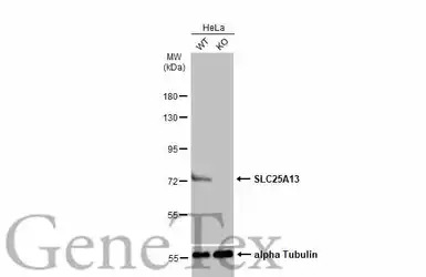 SLC25A13 antibody [N3C2], Inte