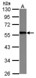 SERBP1 antibody [N1C2]