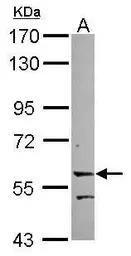 LRRC15 antibody [N1N3]